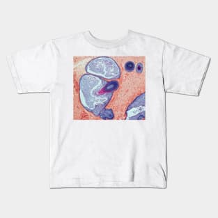 Dermoid ovarian cyst, light micrograph (C019/9256) Kids T-Shirt